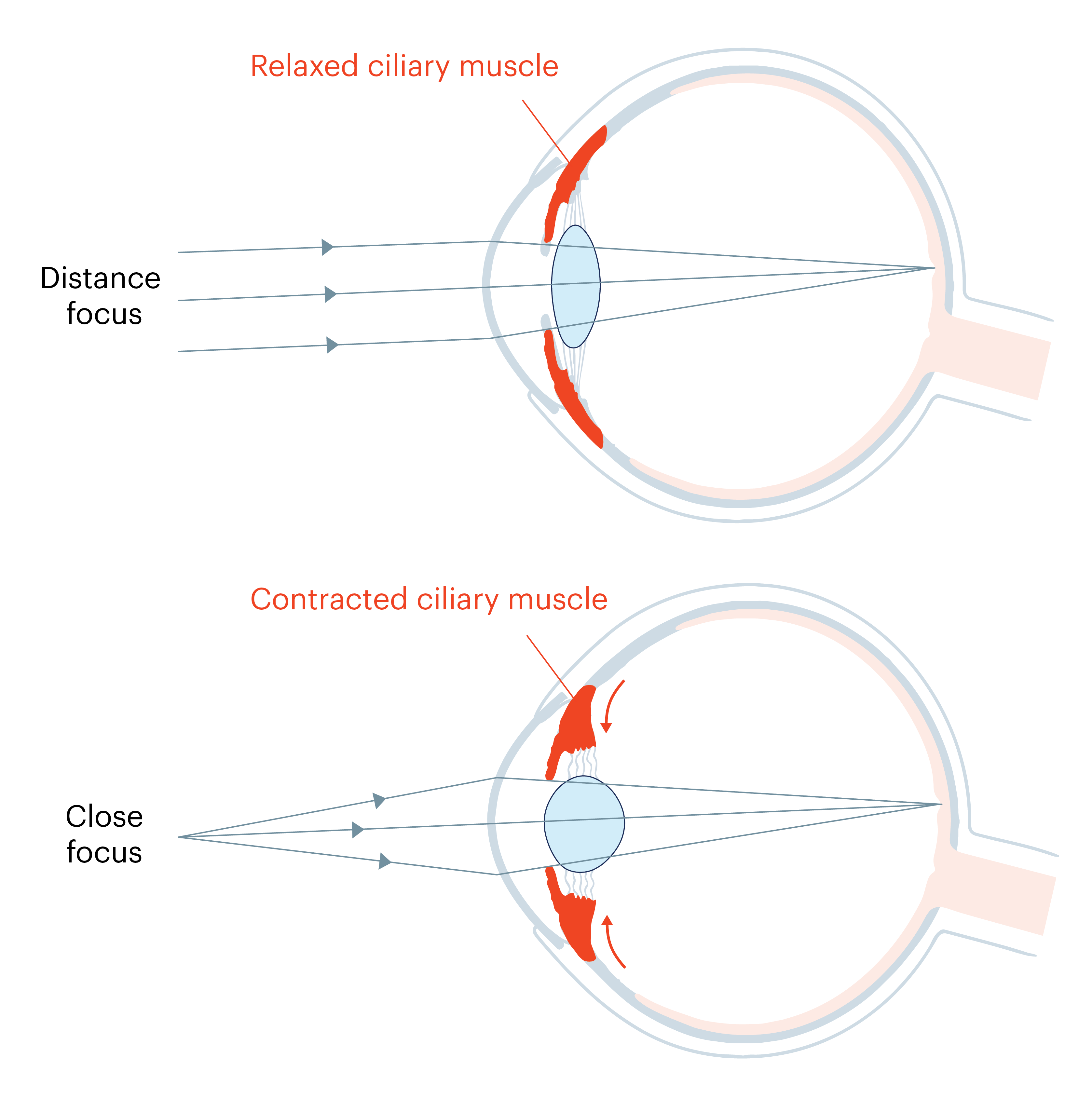 Eye accommodation for close and distance focusing